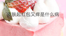 皮肤起红包又痒是什么病 身上长红包很痒是什么原因